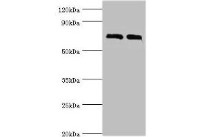 Western blot All lanes: DHX58 antibody at 12 μg/mL Lane 1: 293T whole cell lysate Lane 2: Rat kidney tissue Secondary Goat polyclonal to rabbit IgG at 1/10000 dilution Predicted band size: 77 kDa Observed band size: 77 kDa (DHX58 Antikörper  (AA 389-678))