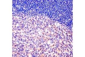 MCM6 antibody immunohistochemistry analysis in formalin fixed and paraffin embedded human tonsil tissue. (MCM6 Antikörper  (AA 80-109))