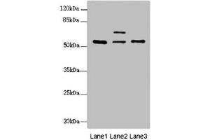Western blot All lanes: ERO1L antibody at 2. (ERO1L Antikörper  (AA 24-260))