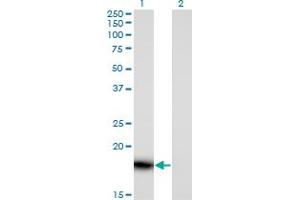 Western Blot analysis of PLA2G16 expression in transfected 293T cell line by PLA2G16 monoclonal antibody (M02), clone 4C4-2A11. (PLA2G16 Antikörper  (AA 1-162))