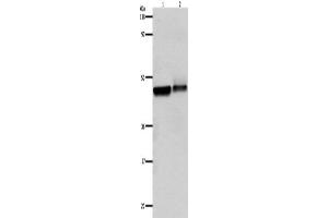 Western Blotting (WB) image for anti-Adrenergic, beta-2-, Receptor, Surface (ADRB2) antibody (ABIN2430973)