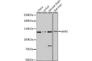 Western blot analysis of extracts of various cell lines, using AARS Rabbit pAb (ABIN7265526) at 1:3000 dilution. (AARS Antikörper  (AA 1-100))