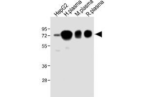 All lanes : Anti-HPX Antibody (Center) at 1:2000 dilution Lane 1: HepG2 whole cell lysate Lane 2: Human plasma lysate Lane 3: Mouse plasma lysate Lane 4: Rat plasma lysate Lysates/proteins at 20 μg per lane. (Hemopexin Antikörper  (AA 200-227))