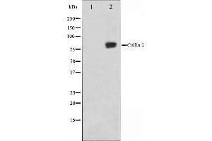 Western blot analysis on LOVO cell lysate using Cullin 2 Antibody,The lane on the left is treated with the antigen-specific peptide. (Cullin 2 Antikörper  (C-Term))