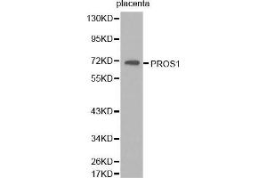 Western Blotting (WB) image for anti-Protein S (PROS) (AA 405-676) antibody (ABIN6218667) (PROS1 Antikörper  (AA 405-676))