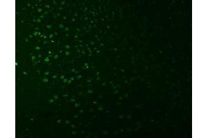 IF analysis of SNRNP27 using anti-SNRNP27 antibody (ABIN7599614). (SNRNP27 Antikörper  (AA 100-155))