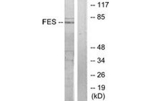 Western blot analysis of extracts from HuvEc cells, treated with serum 20% 30', using FES Antibody. (FES Antikörper  (AA 131-180))