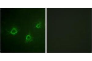 Immunofluorescence analysis of COS7 cells, using PLCG1 (Ab-1253) Antibody. (Phospholipase C gamma 1 Antikörper  (AA 1221-1270))