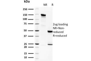 SDS-PAGE Analysis Purified Spermidine Monoclonal Antibody (CPTC-SAT1-3). (SAT1 Antikörper)