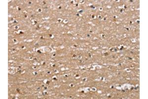 The image on the left is immunohistochemistry of paraffin-embedded Human brain tissue using ABIN7189673(ADGRB2 Antibody) at dilution 1/25, on the right is treated with synthetic peptide. (BAI2 Antikörper)