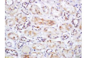 Formalin-fixed and paraffin embedded human kidney labeled with Rabbit Anti-SLC25A10 Polyclonal Antibody, Unconjugated  at 1:200 followed by conjugation to the secondary antibody and DAB staining