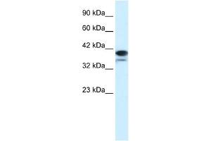 PARP6 antibody used at 1. (PARP6 Antikörper)