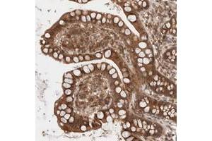Immunohistochemical staining of human small intestine with RP5-1000E10.