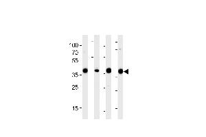 Western blot analysis of lysates from 293,RD,mouse NIH/3T3,rat L6 cell line (from left to right),using ALDOA Antibody (N-term) (ABIN389191 and ABIN2839354). (ALDOA Antikörper  (N-Term))
