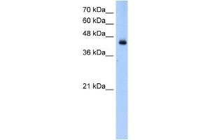 Transfected 293T; WB Suggested Anti-ACADL Antibody Titration: 0. (ACADL Antikörper  (N-Term))