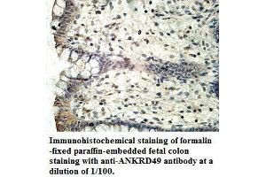 Image no. 1 for anti-Ankyrin Repeat Domain 49 (ANKRD49) antibody (ABIN1574707) (ANKRD49 Antikörper)