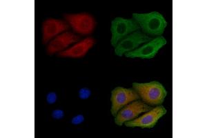 ABIN6258424 and ABIN6275641 staining Hela cells by IF/ICC.