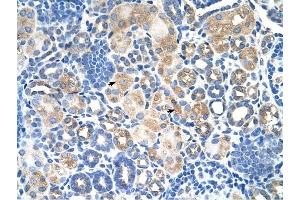 SLC38A1 antibody was used for immunohistochemistry at a concentration of 4-8 ug/ml to stain EpitheliaI cells of renal tubule (arrows) in Human Kidney. (SLC38A1 Antikörper  (Middle Region))