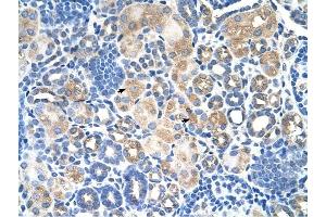 SLC38A1 antibody was used for immunohistochemistry at a concentration of 4-8 ug/ml to stain EpitheliaI cells of renal tubule (arrows) in Human Kidney.