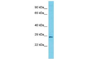 Host: Rabbit Target Name: C11orf70 Sample Type: Jurkat Whole Cell lysates Antibody Dilution: 1. (C11ORF70 Antikörper  (C-Term))