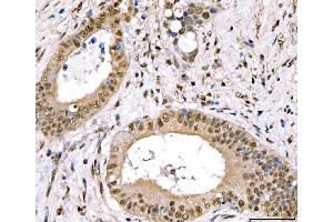 IHC analysis of CRTC3 using anti-CRTC3 antibody (ABIN7599779). (CRTC3 Antikörper  (AA 116-619))