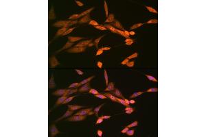 Immunofluorescence analysis of NIH-3T3 cells using DISC1 Rabbit mAb (ABIN7266799) at dilution of 1:100 (40x lens). (DISC1 Antikörper)