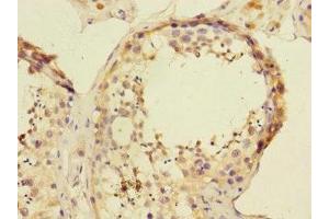 Immunohistochemistry of paraffin-embedded human testis tissue using ABIN7144788 at dilution of 1:100 (Ataxin 1 Antikörper  (AA 346-475))