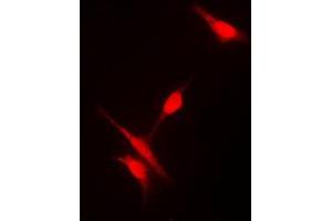Immunofluorescent analysis of Histone Deacetylase 10 staining in Jurkat cells. (HDAC10 Antikörper  (N-Term))