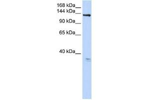 WB Suggested Anti-TMEM16C Antibody Titration:  0. (ANO3 Antikörper  (C-Term))