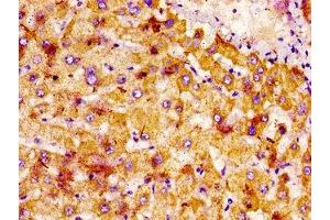 IHC image of ABIN7161191 diluted at 1:400 and staining in paraffin-embedded human liver tissue performed on a Leica BondTM system. (Netrin 1 Antikörper  (AA 186-478))