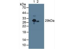 Western blot analysis of (1) Rat Serum and (2) Mouse Serum. (CRP Antikörper  (AA 17-224))