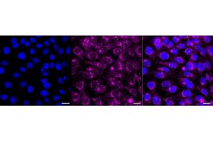 Immunocytochemical staining of HT- cells with Amyloid beta precursor protein antibody (ABIN7797593), 1:1,000). (Rekombinanter APP Antikörper)