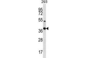 Western blot analysis in 293 cell line lysates (35ug/lane) using NKX2-2  Antibody . (Nkx2-2 Antikörper  (Middle Region))