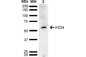 Western blot analysis of Mouse testis lysate showing detection of ~59. (FZD4 Antikörper  (AA 100-200) (Atto 488))