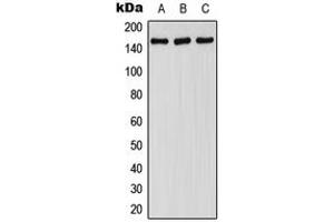 Western blot analysis of FANCA (pS1149) expression in HepG2 EGF-treated (A), SP2/0 EGF-treated (B), H9C2 EGF-treated (C) whole cell lysates.