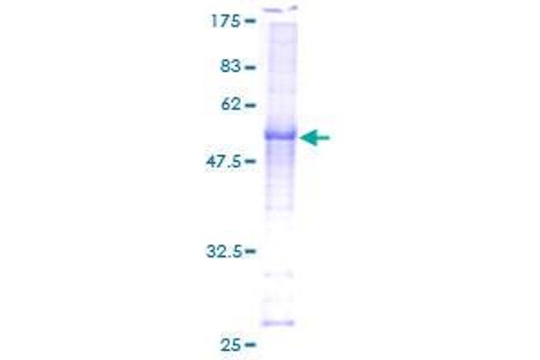 Cyclin C Protein (CCNC) (AA 1-283) (GST tag)