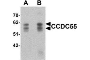Western blot analysis of CCDC55 in human brain tissue lysate with CCDC55 antibody at (A) 0. (NSRP1 Antikörper  (C-Term))