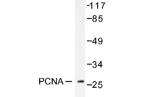 Image no. 1 for anti-Proliferating Cell Nuclear Antigen (PCNA) antibody (ABIN271780) (PCNA Antikörper)