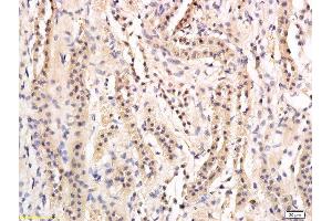 Formalin-fixed and paraffin embedded rat kidney labeled with Anti-phospho-AQP2(Ser269) Polyclonal Antibody, Unconjugated  followed by conjugation to the secondary antibody and DAB staining (AQP2 Antikörper  (pSer269))