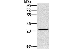 Western blot analysis of Human testis tissue, using CLIC1 Polyclonal Antibody at dilution of 1:400 (CLIC1 Antikörper)