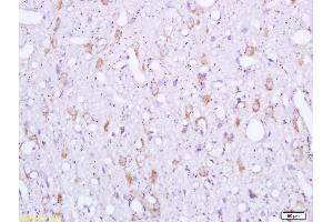 Formalin-fixed and paraffin embedded rat brain labeled with Rabbit Anti Sigma1R/OPRS1/Sigma Receptor Polyclonal Antibody, Unconjugated (ABIN709841) at 1:200 followed by conjugation to the secondary antibody and DAB staining (SIGMAR1 Antikörper  (AA 21-120))