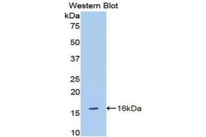 Western blot analysis of the recombinant protein. (ADAMTS1 Antikörper  (AA 854-967))