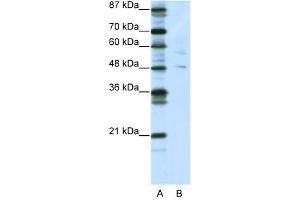 PLAGL1 antibody (20R-1207) used at 0. (PLAGL1 Antikörper  (N-Term))