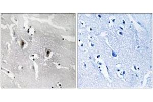 Immunohistochemistry analysis of paraffin-embedded human brain tissue, using RBM6 Antibody. (RBM6 Antikörper  (AA 991-1040))