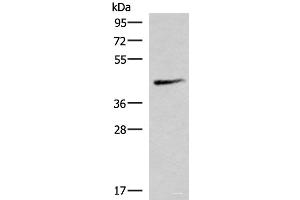 Western blot analysis of Mouse lung tissue lysate using SMPD2 Polyclonal Antibody at dilution of 1:1000 (SMPD2 Antikörper)