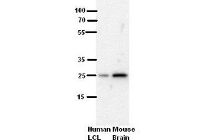 WB Suggested Anti-SH3BGR Antibody Blocking:  5% Milk  Antibody dilution:  1:500  Positive Control:  human LCL and mouse brains (SH3BGR Antikörper  (N-Term))