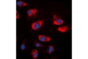Immunofluorescent analysis of Cystatin A staining in A549 cells. (CSTA Antikörper)