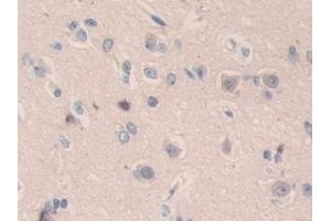 Immunohistochemistry (IHC) image for anti-Structural Maintenance of Chromosomes 3 (SMC3) (AA 994-1181) antibody (ABIN7440092)
