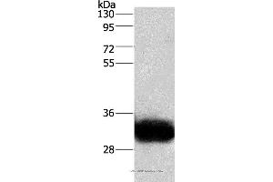 Western blot analysis of Human fetal brain tissue, using GPM6A Polyclonal Antibody at dilution of 1:950 (GPM6A Antikörper)