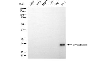 Western blotting analysis using crystallin alpha B antibody (ABIN7798169).
